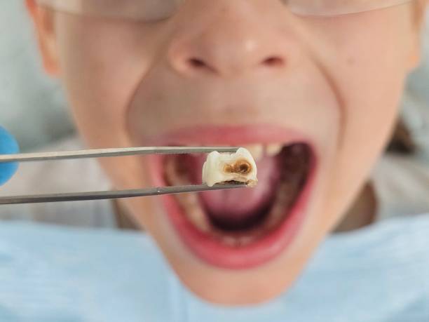 Best Emergency Denture Repair in Hazel Crest, IL